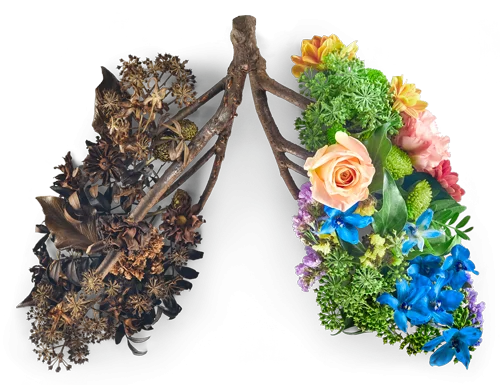 PHE lungs